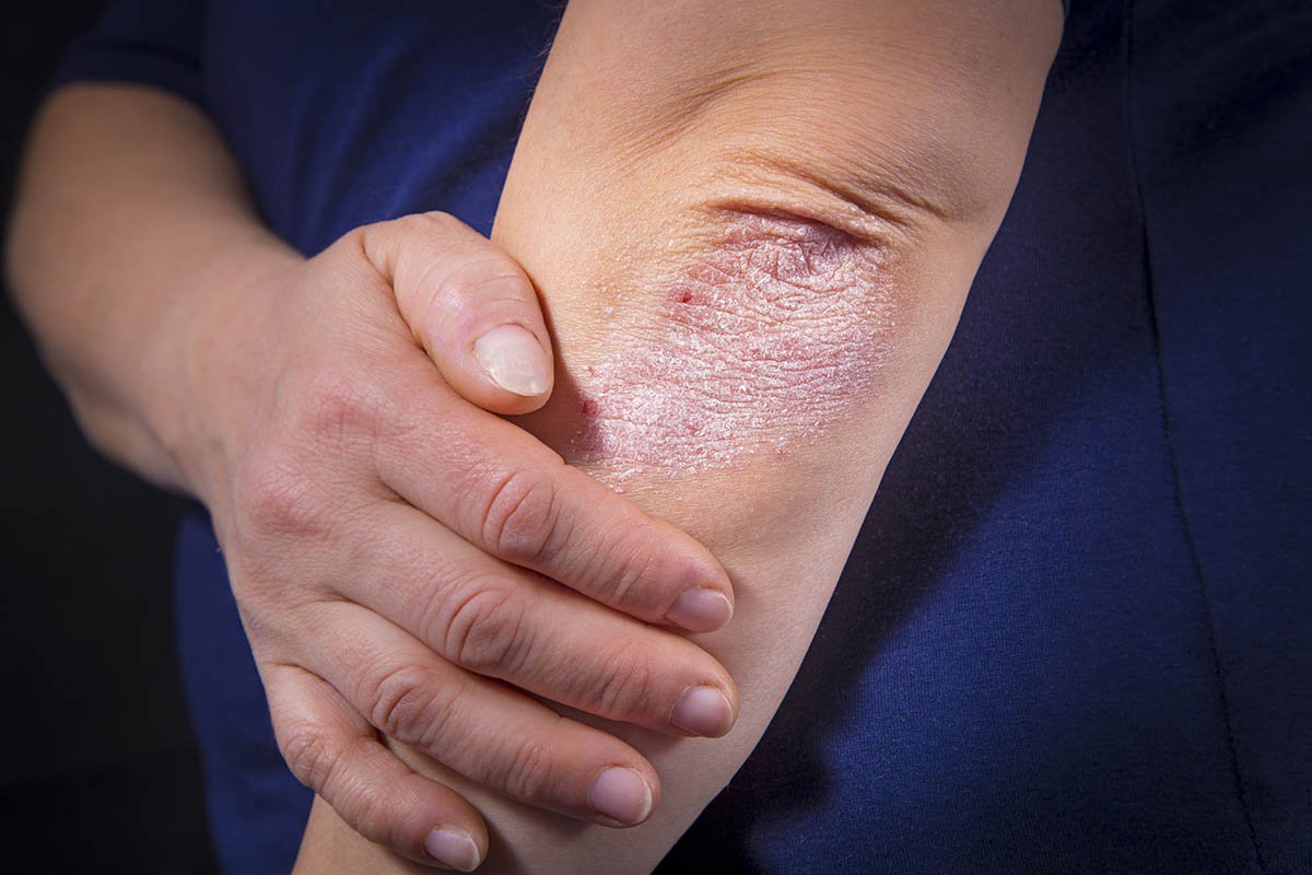 ISTOCKPHOTO, 