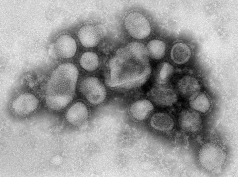 , Kuva: Centers for Disease Control and Prevention